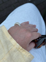 LIDO RING